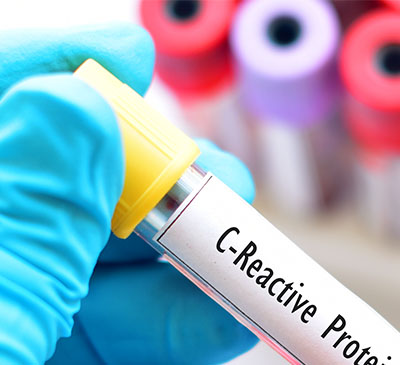 Global C-Reactive Protein Test Market 2019-2023